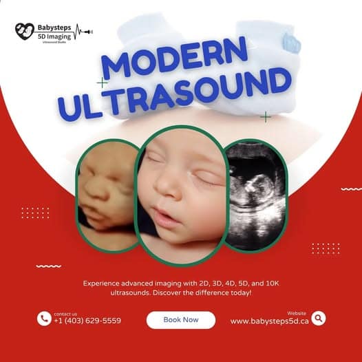 Baby Steps 5d Ultrasound